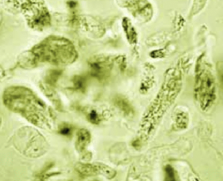 Close up of the termite gut microbiome