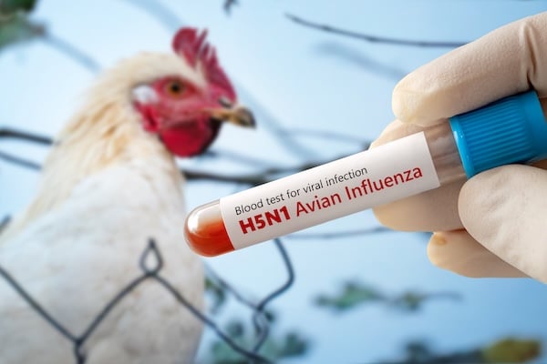 A test tube with a blood test for h5n1 avian influenza